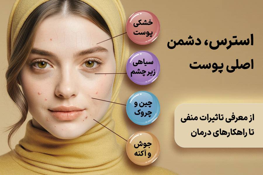 استرس دشمن اصلی پوسته